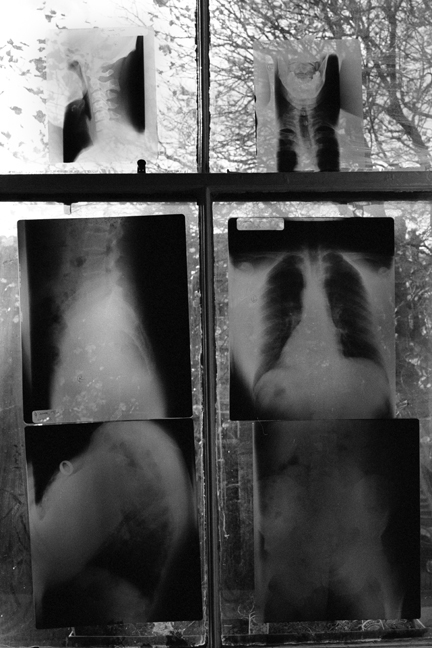 X-rays, Northumberland Road, Dublin, Ireland, December 2003